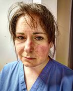 Nurse Aimée Goold after a 13-hour shift treating coronavirus patients © Aimée Goold 